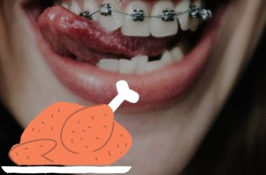 Artistic Can I Eat Chicken With Braces Abstract in 4K Artistic Can I Eat Chicken With Braces Abstract in 4K